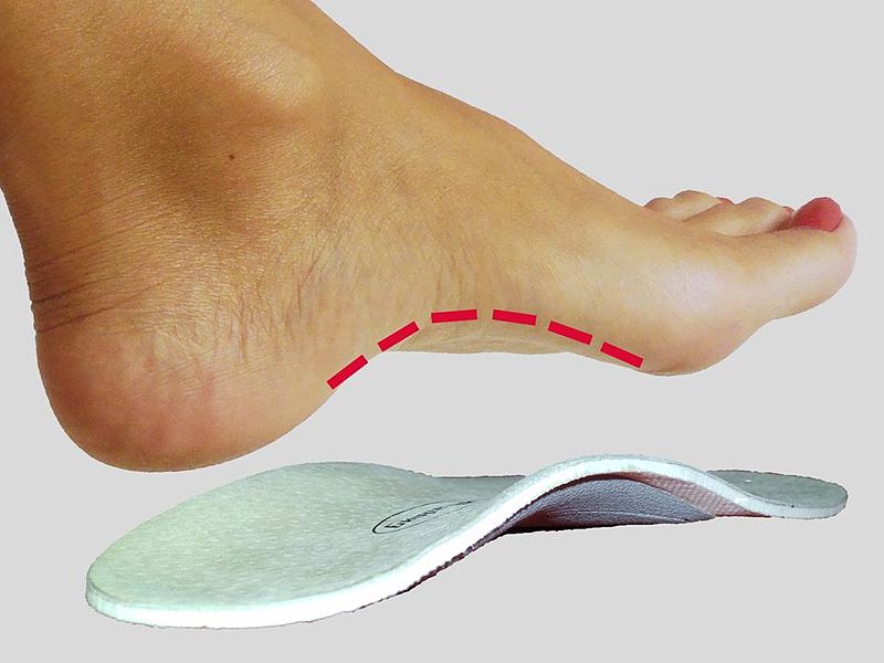 The Best Insoles Guide 101: Types, Foot Problems & Solutions